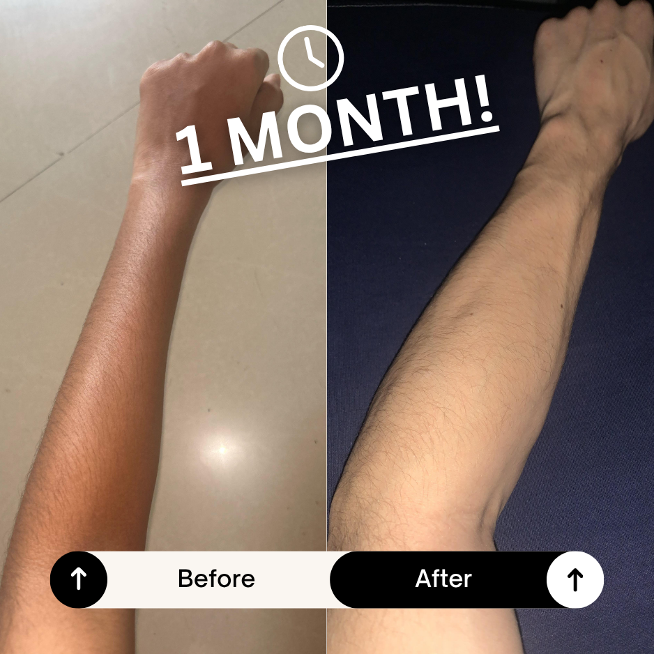 ForearmPro V2 — Military-Grade Strength